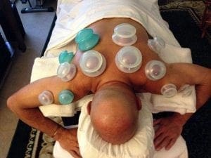 Myofascial Cupping